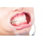 10 Morelli NiTi Dental Intraoral Orthotodontic Archwire Super